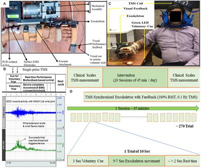 Individualized closed-loop TMS synchronized with exoskeleton for modulation of cortical-excitability in patients with stroke: a proof-of-concept study